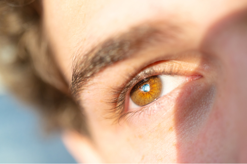 Symptoms Of Sunburned Eye