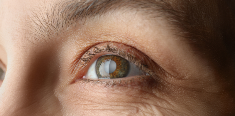 How to Spot Cataract Symptoms This Spring